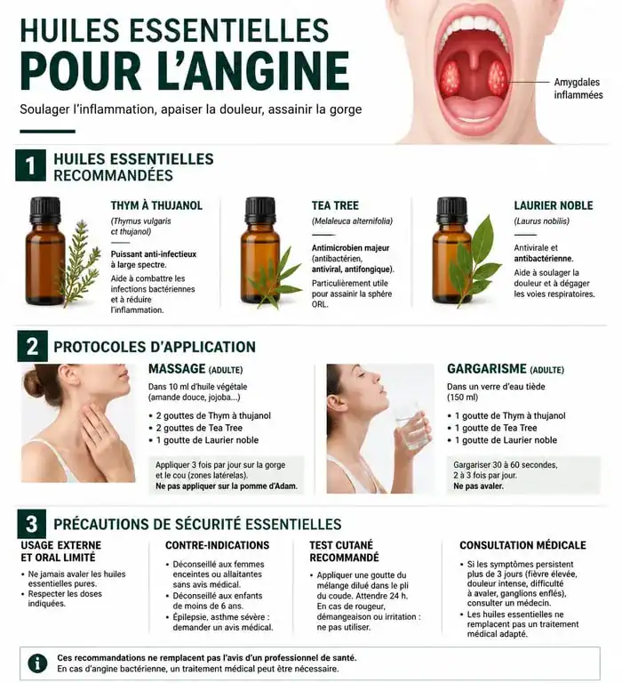 Infographie sur l'utilisation des huiles essentielles pour soulager une angine et précautions d'usage