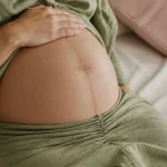Trait de grossesse sur le ventre : linea nigra, fille ou garçon